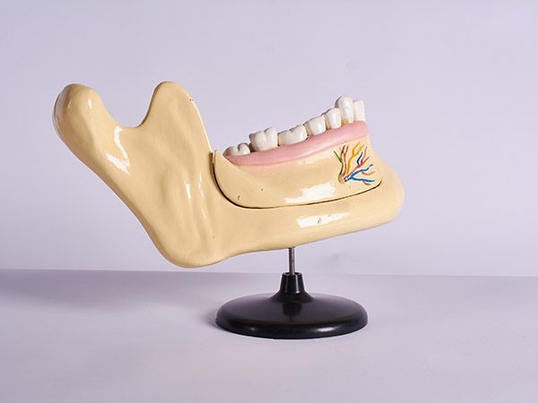 牙列及磨牙模型
